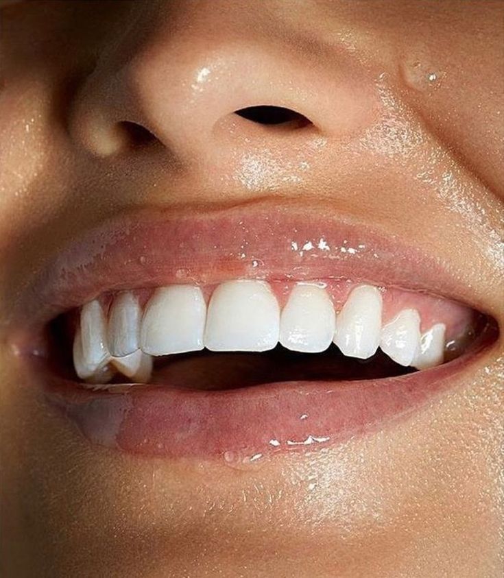 Healthy Teeth : White and Healthy Teeth